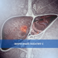 Вирусный гепатит С