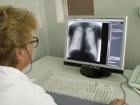 Эпидемиологическая ситуация по туберкулезу в Волгоградской области стабилизируется