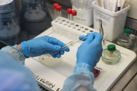В Волгоградской области повышается доступность лабораторных исследований на определение онкомаркеров